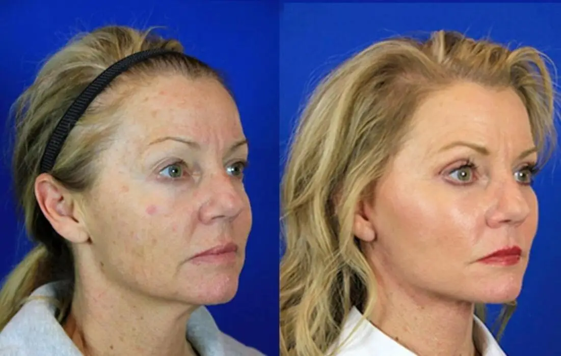 Overall Rejuvenation